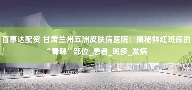 百事达配资 甘肃兰州五洲皮肤病医院：揭秘鲜红斑痣的“青睐”部位_患者_斑疹_发病